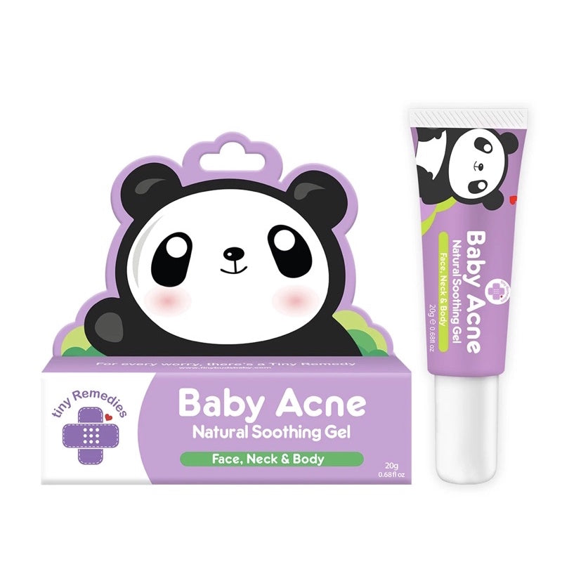 Tiny Buds Baby Acne Natural Soothing Gel for Face, Neck and Body