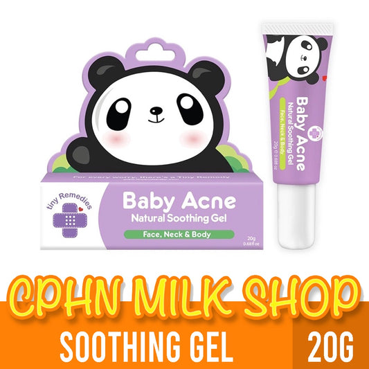 Tiny Buds Baby Acne Natural Soothing Gel for Face, Neck and Body